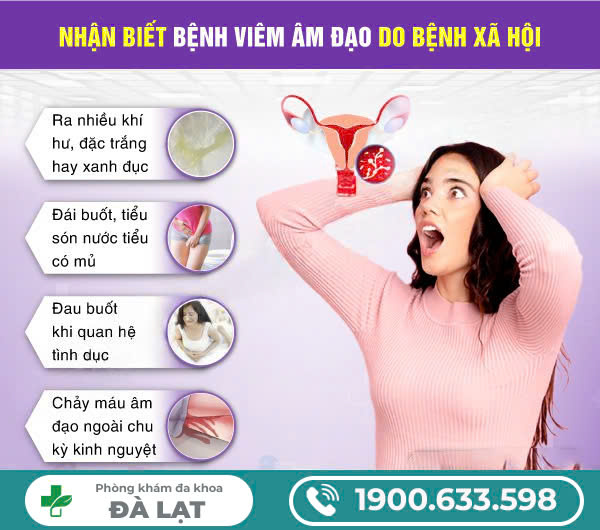Hình ảnh minh họa